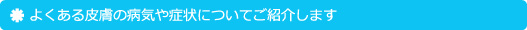 よくある皮膚の病気や症状についてご紹介します
